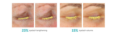 FACTORFIVE eyelash results with Lash/Brow Growth Serum