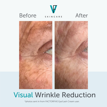 FACTORFIVE Skincare Eye/Lash Cream wrinkle results