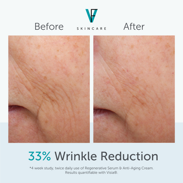 FACTORFIVE Skincare Anti-Aging Cream wrinkle results
