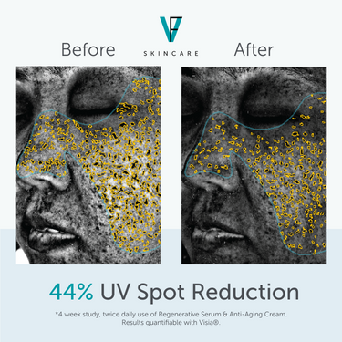 FACTORFIVE Skincare Anti-Aging Cream UV Spot results
